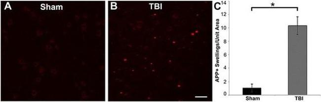 beta Amyloid Antibody in Immunohistochemistry (IHC)