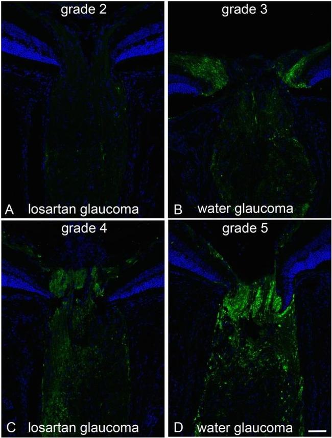 beta Amyloid Antibody in Immunohistochemistry (IHC)