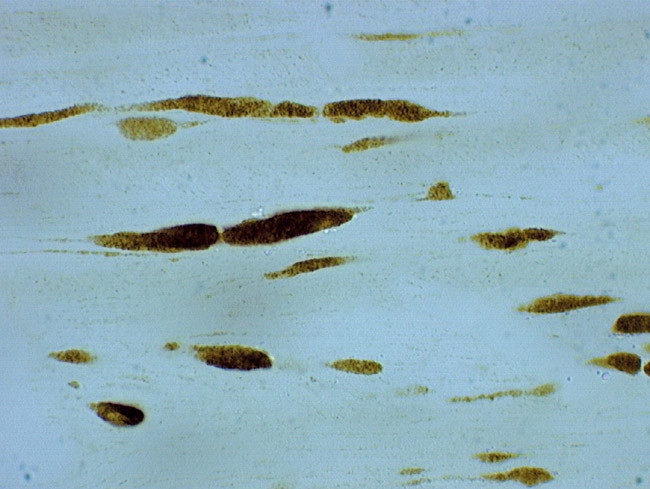 beta Amyloid Antibody in Immunohistochemistry (IHC)