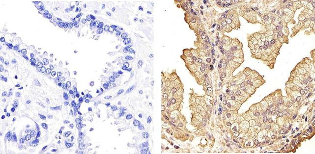 NFkB p50 Antibody in Immunohistochemistry (Paraffin) (IHC (P))