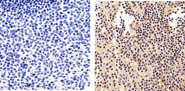 NFkB p50 Antibody in Immunohistochemistry (Paraffin) (IHC (P))