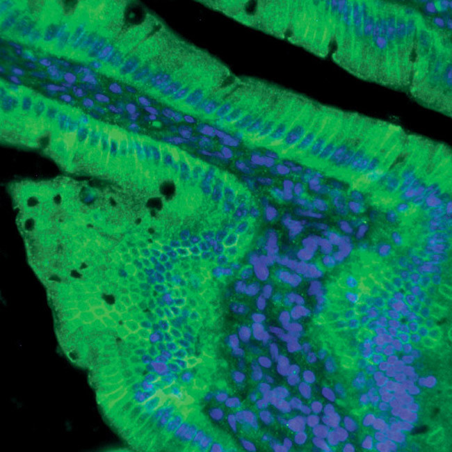 Claudin 2 Antibody in Immunohistochemistry (IHC)