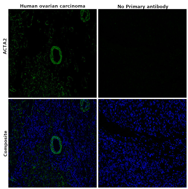 Alpha-Smooth Muscle Actin Antibody in Immunohistochemistry (Paraffin) (IHC (P))