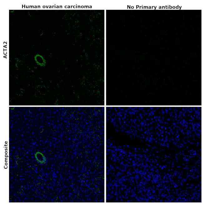 Alpha-Smooth Muscle Actin Antibody in Immunohistochemistry (Paraffin) (IHC (P))