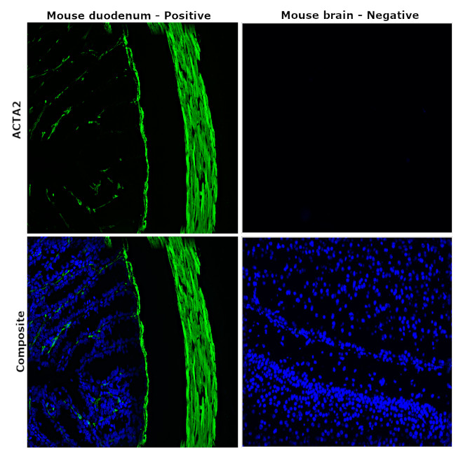 Alpha-Smooth Muscle Actin Antibody in Immunohistochemistry (Paraffin) (IHC (P))