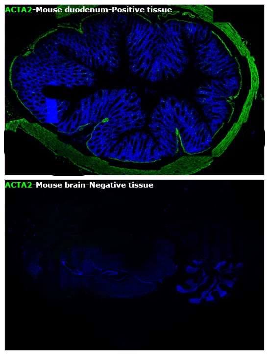 Alpha-Smooth Muscle Actin Antibody in Immunohistochemistry (Paraffin) (IHC (P))