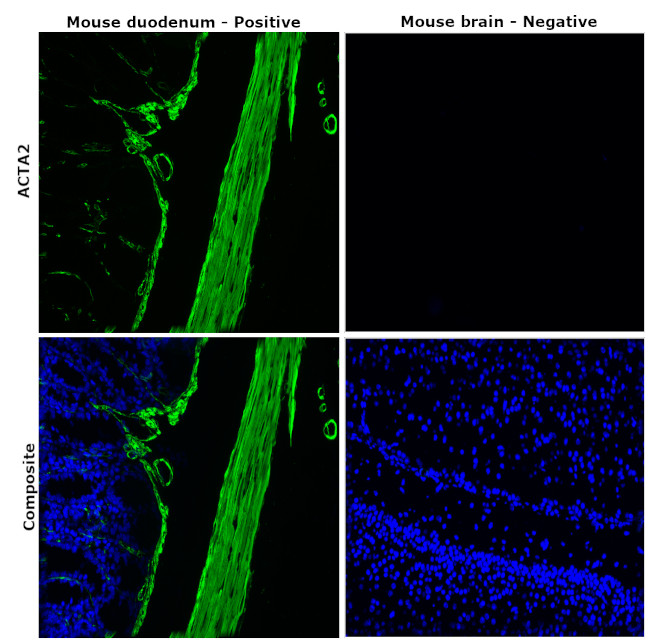 Alpha-Smooth Muscle Actin Antibody