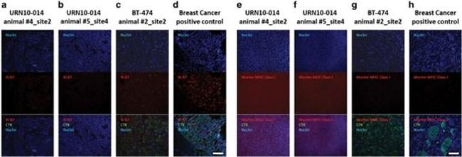 Pan Cytokeratin Antibody in Immunohistochemistry (IHC)