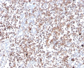 Protein Kinase C alpha/PRKCA Antibody in Immunohistochemistry (Paraffin) (IHC (P))