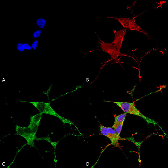 Leucine-Rich Repeat Kinase 2 (LRRK2) Antibody in Immunocytochemistry (ICC/IF)