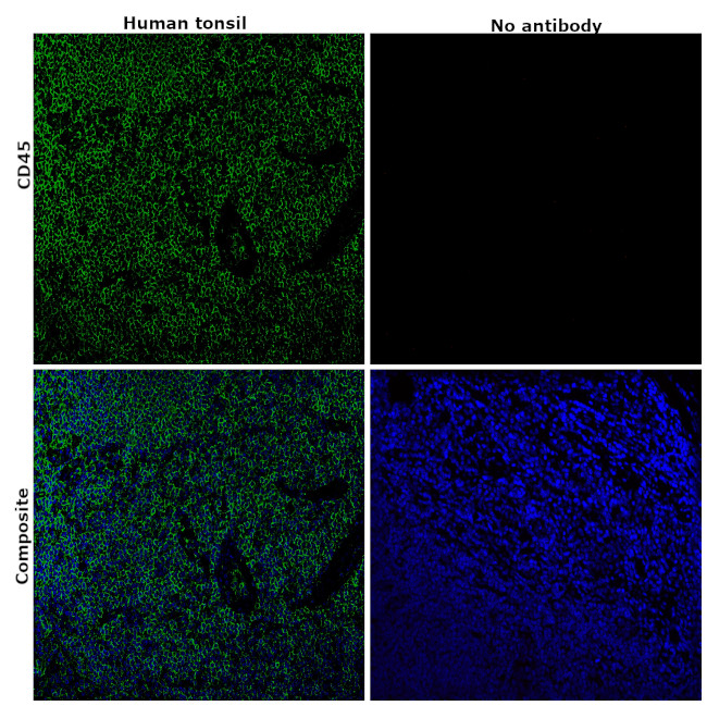 CD45 Antibody in Immunohistochemistry (Paraffin) (IHC (P))