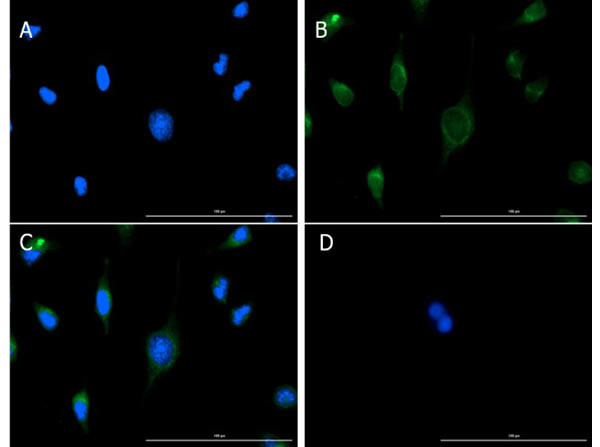 VDAC/Porin Antibody in Immunocytochemistry (ICC/IF)