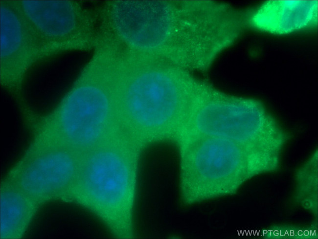 BCL2 Antibody in Immunocytochemistry (ICC/IF)