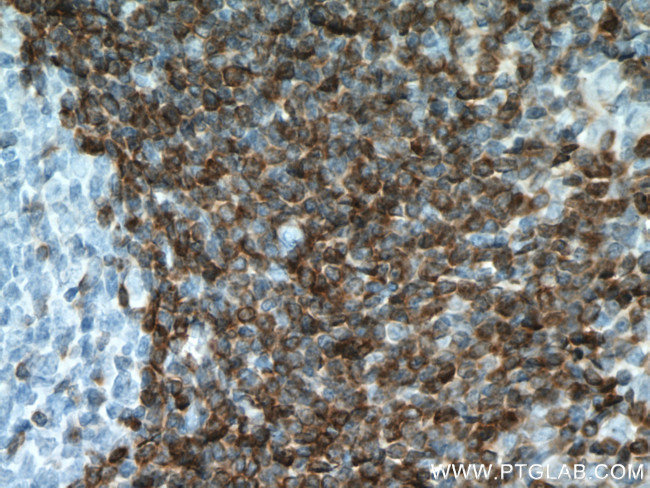 BCL2 Antibody in Immunohistochemistry (Paraffin) (IHC (P))