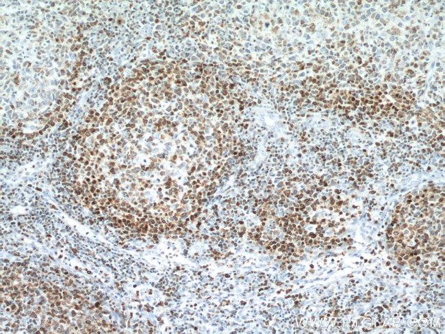 BCL2 Antibody in Immunohistochemistry (Paraffin) (IHC (P))