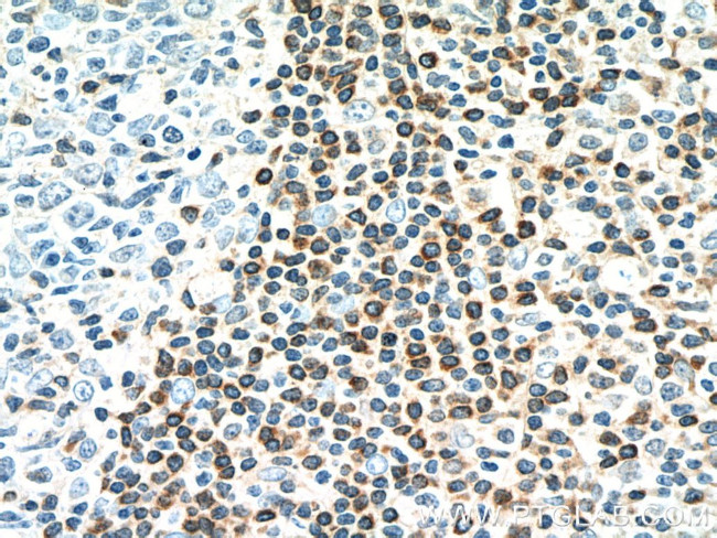 BCL2 Antibody in Immunohistochemistry (Paraffin) (IHC (P))