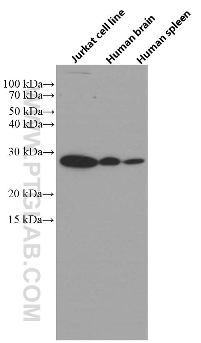 BCL2 Antibody in Western Blot (WB)