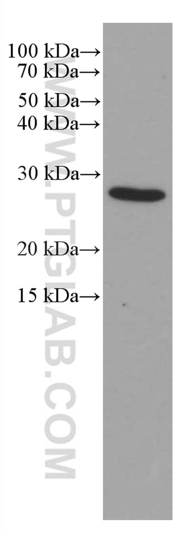 BCL2 Antibody in Western Blot (WB)