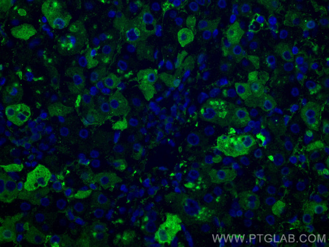 TNFR1 Antibody in Immunohistochemistry (PFA fixed) (IHC (PFA))