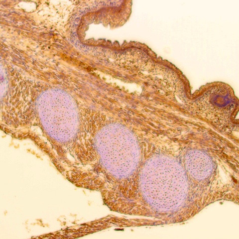 SSEA-3 Antibody in Immunohistochemistry (Paraffin) (IHC (P))