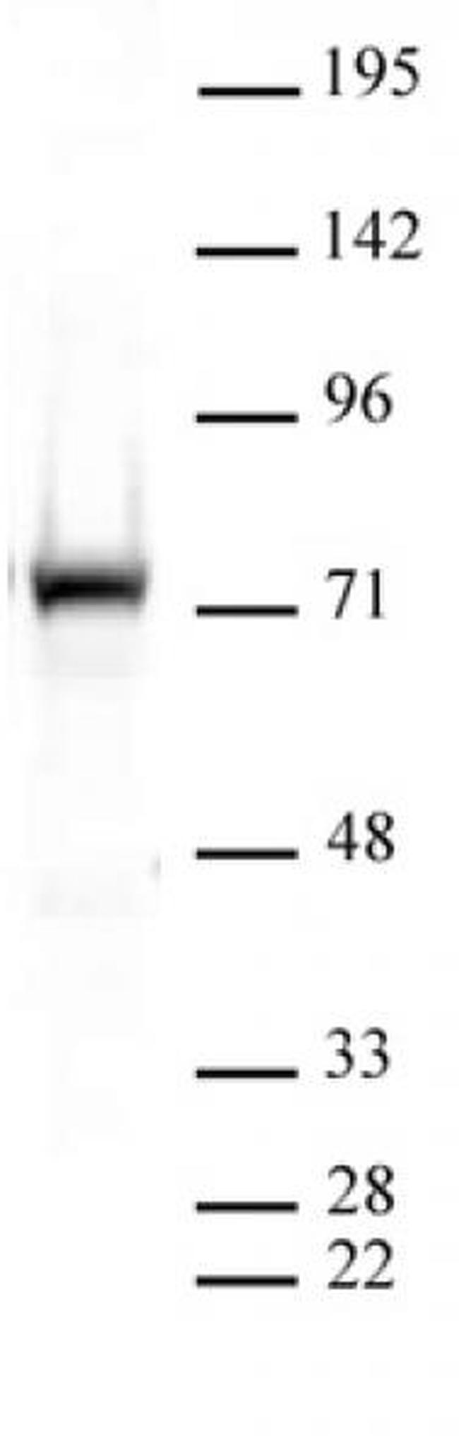 PRMT5 Antibody in Western Blot (WB)