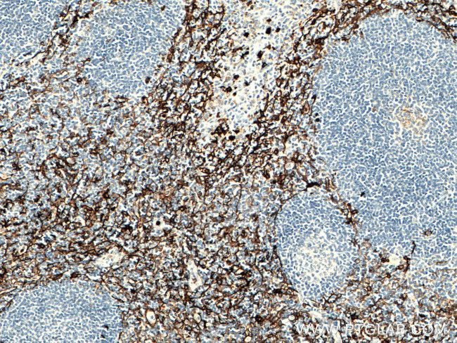 CD13 Antibody in Immunohistochemistry (Paraffin) (IHC (P))