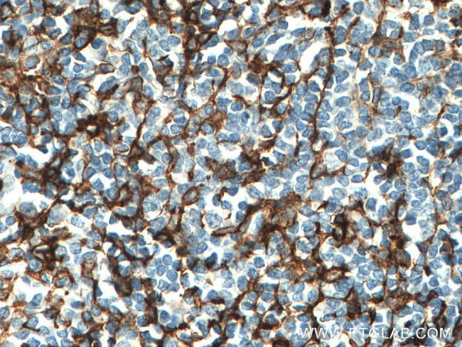 CD13 Antibody in Immunohistochemistry (Paraffin) (IHC (P))