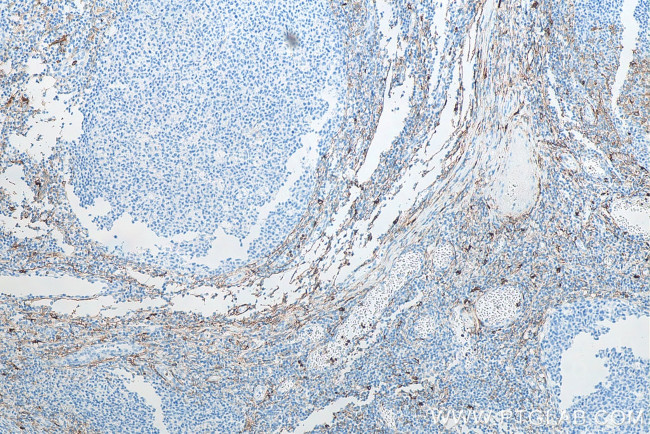 CD13 Antibody in Immunohistochemistry (Paraffin) (IHC (P))