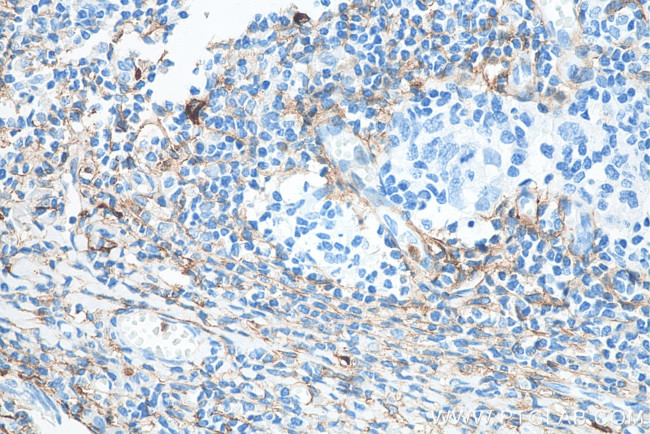 CD13 Antibody in Immunohistochemistry (Paraffin) (IHC (P))