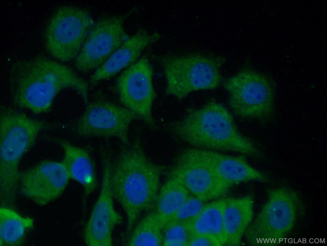 14-3-3 sigma Antibody in Immunocytochemistry (ICC/IF)