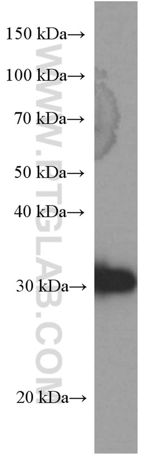 14-3-3 sigma Antibody in Western Blot (WB)