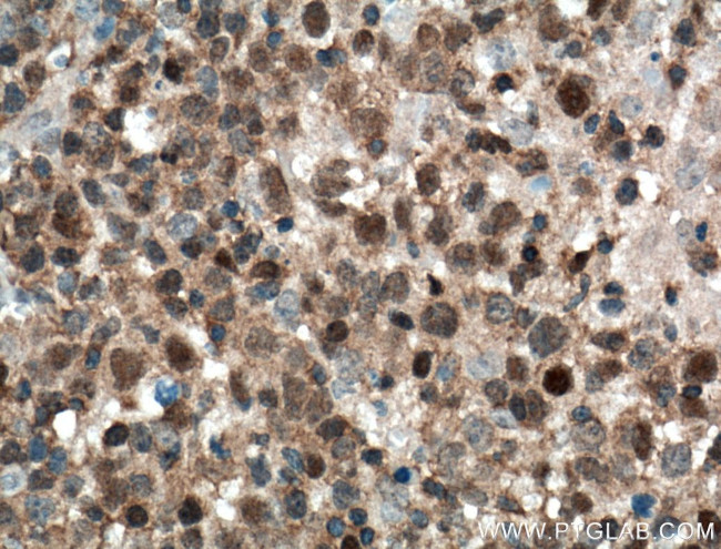 BCL6 Antibody in Immunohistochemistry (Paraffin) (IHC (P))