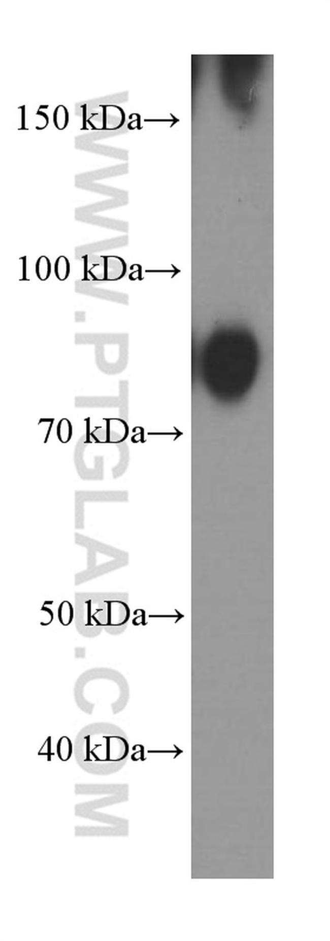 BCL6 Antibody in Western Blot (WB)