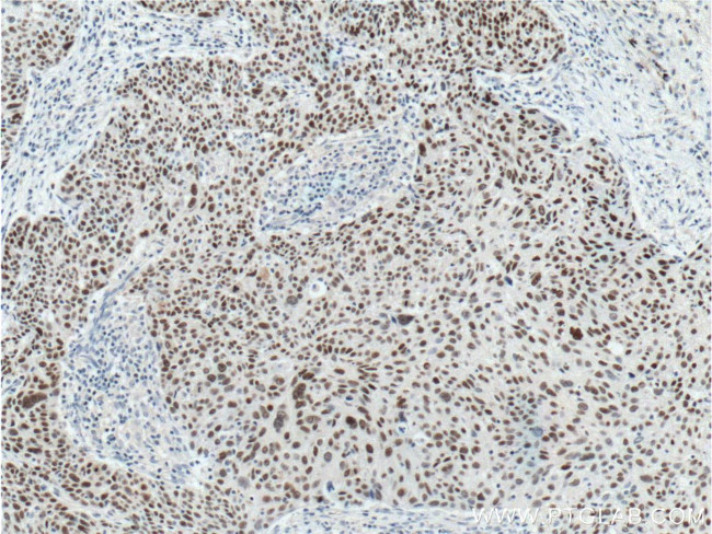 SOX2 Antibody in Immunohistochemistry (Paraffin) (IHC (P))