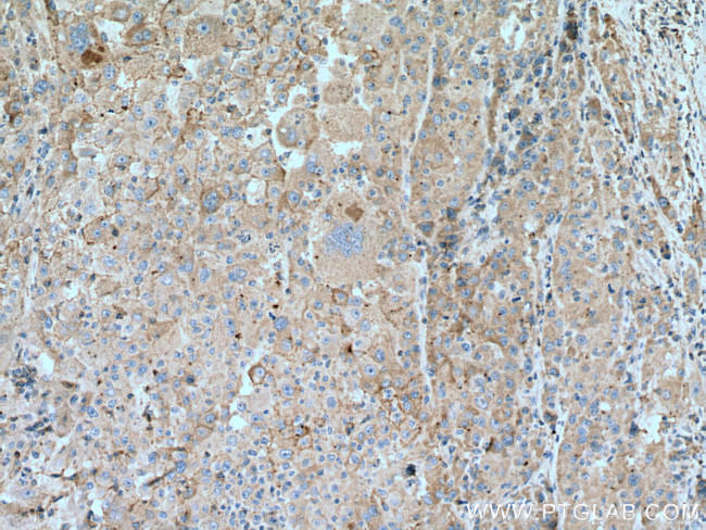 IL-6R Antibody in Immunohistochemistry (Paraffin) (IHC (P))