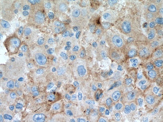 IL-6R Antibody in Immunohistochemistry (Paraffin) (IHC (P))