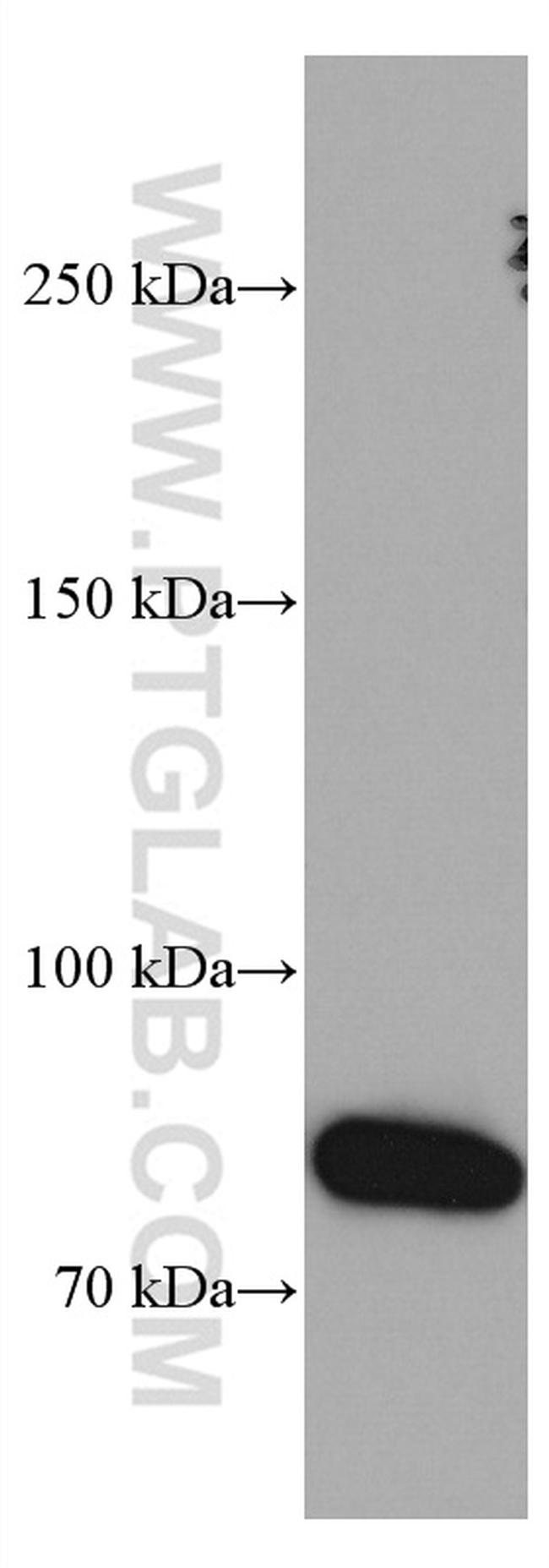 IL-6R Antibody in Western Blot (WB)