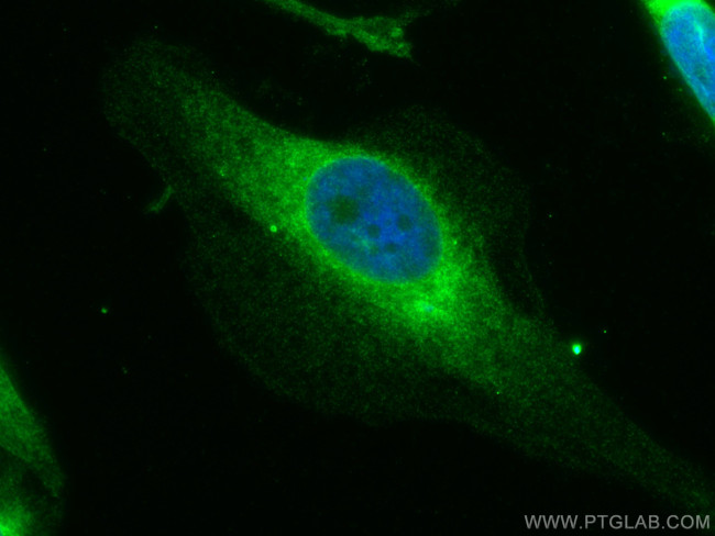 GSK3B Antibody in Immunocytochemistry (ICC/IF)