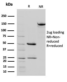 STAT5B Antibody in SDS-PAGE (SDS-PAGE)