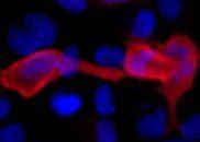 6x-His Tag Antibody in Immunocytochemistry (ICC/IF)