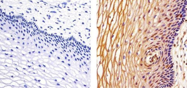 IRAK4 Antibody in Immunohistochemistry (Paraffin) (IHC (P))