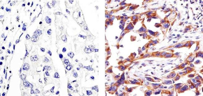 Caspase 3 Antibody in Immunohistochemistry (Paraffin) (IHC (P))