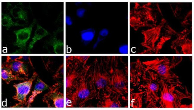 Caspase 3 Antibody in Immunocytochemistry (ICC/IF)