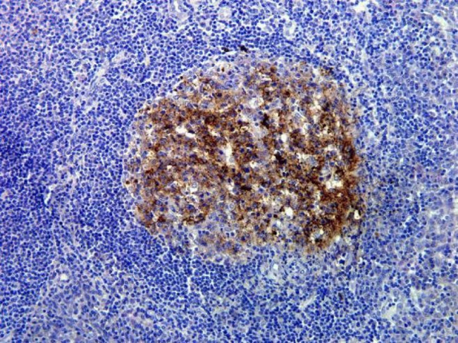 Caspase 3 Antibody in Immunohistochemistry (Paraffin) (IHC (P))