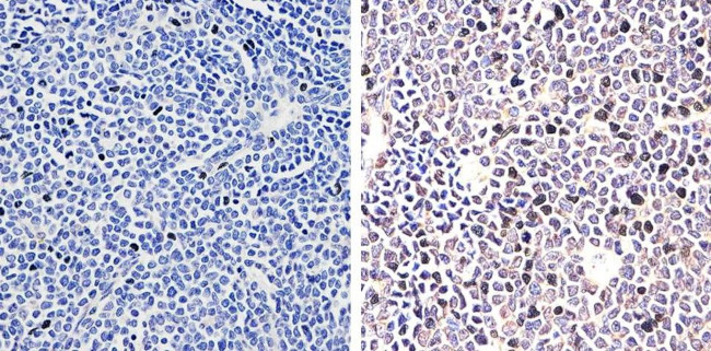 STAT4 Antibody in Immunohistochemistry (Paraffin) (IHC (P))