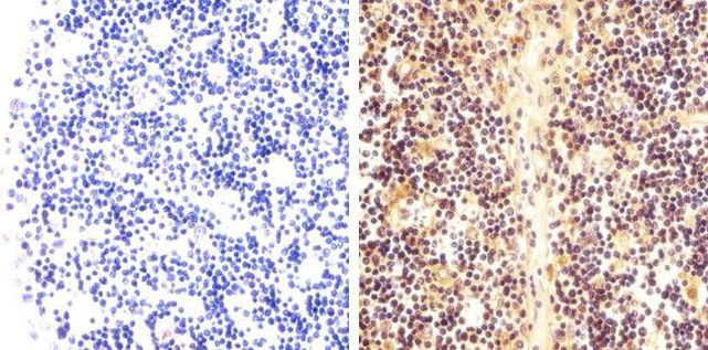 Phospho-STAT6 (Tyr641) Antibody in Immunohistochemistry (Paraffin) (IHC (P))