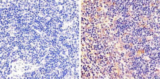 Phospho-STAT6 (Tyr641) Antibody in Immunohistochemistry (Paraffin) (IHC (P))