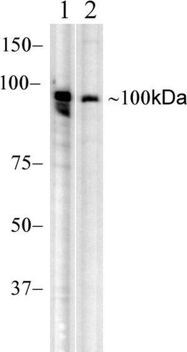 RIG-I Antibody in Western Blot (WB)