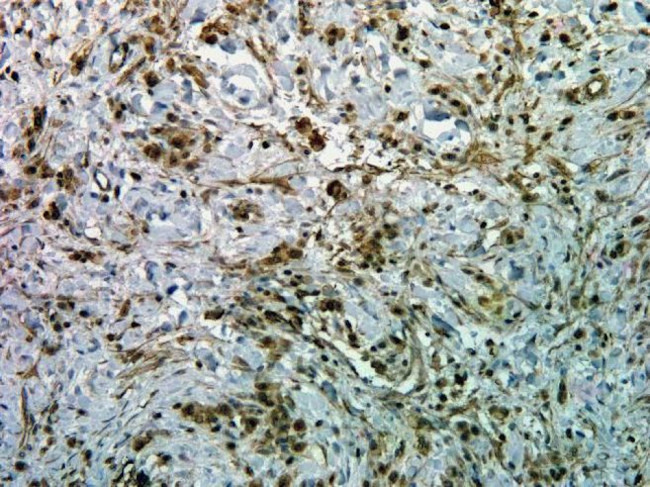 Phospho-AKT1 (Ser473) Antibody in Immunohistochemistry (Paraffin) (IHC (P))