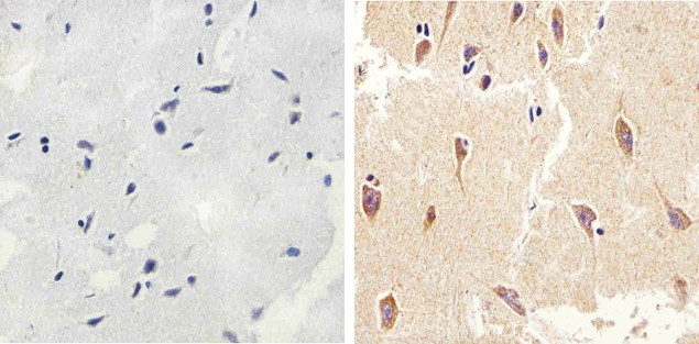 LC3B Antibody in Immunohistochemistry (Paraffin) (IHC (P))